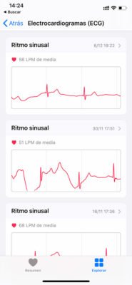 Apple Watch - ECG